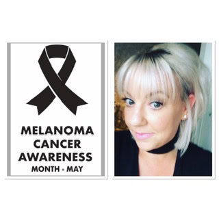Charlene Duckworth is swimming everyday in May to fundraise for Melanoma UK