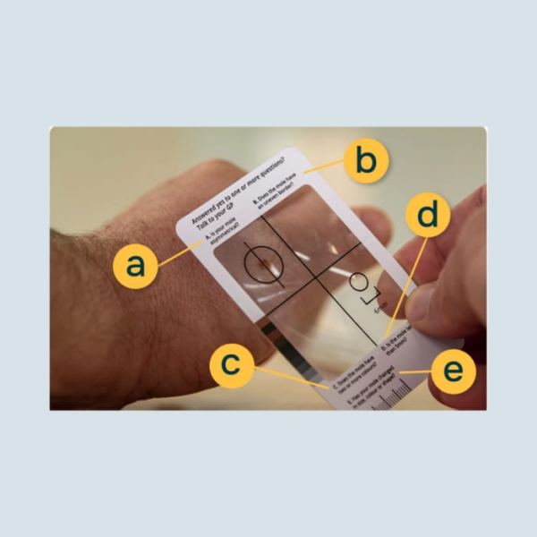 Melanoma Skin Check Tool Kit