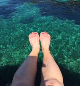 ME MELANOMA, NO CHANCE!
