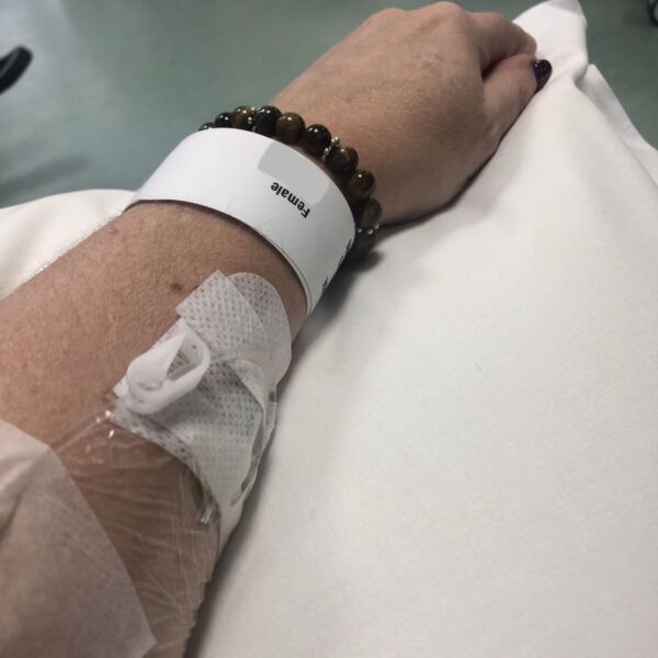 THE BIOPSIES WERE TAKEN AND I WAS ASKED TO TAKE A SEAT!