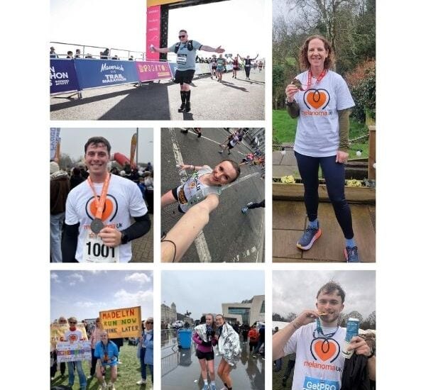 Running across the UK for melanoma awareness and research.