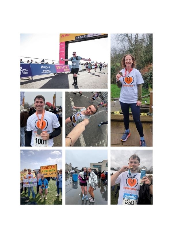 Running across the UK for melanoma awareness and research.